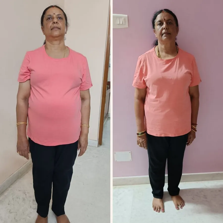 Transformation 9